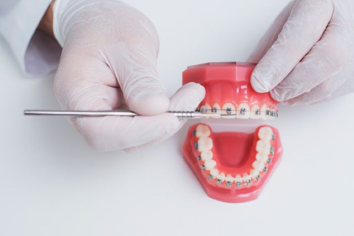 Ortodont: Ključ do zdravega nasmeha